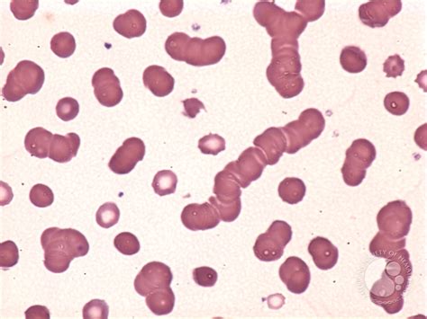 roulette formation in blood cells